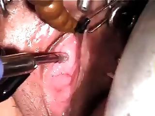 Urethra Insertion Orgasm Wf